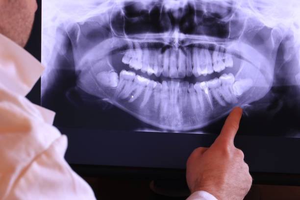 Best Broken or Cracked Tooth Emergency Dentist in Poplar Plains, CT