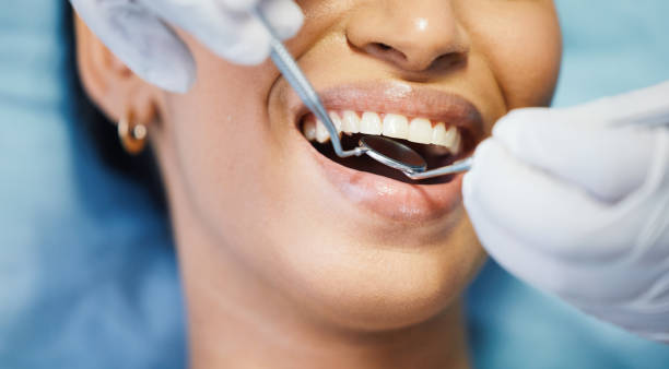 Best Emergency Dentist for Lost Fillings or Crowns in Poplar Plains, CT